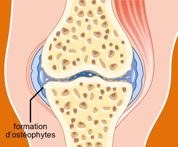 Stades et évolution de l'arthrose du chat