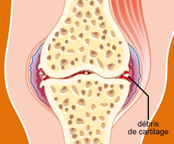 Stades et évolution de l'arthrose du chat