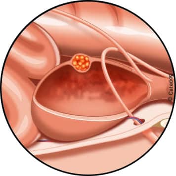 Cystite et infection urinaire chez le chat stressé