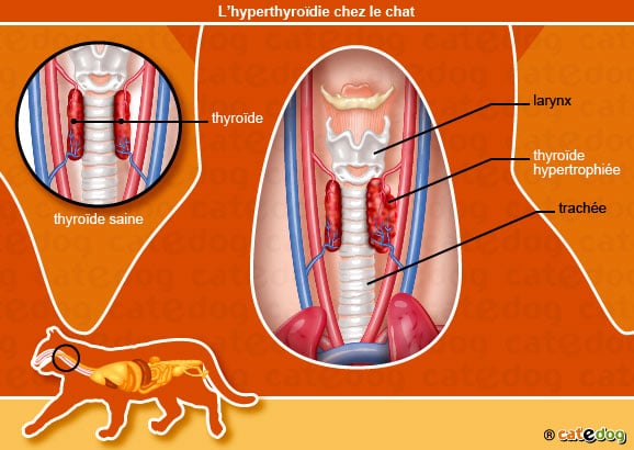 hyperthyroidie_chat