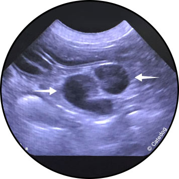 Lymphome du chien et du chat avec échographie
