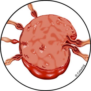 Lymphome du chat et du chien avec ganglion tumoral