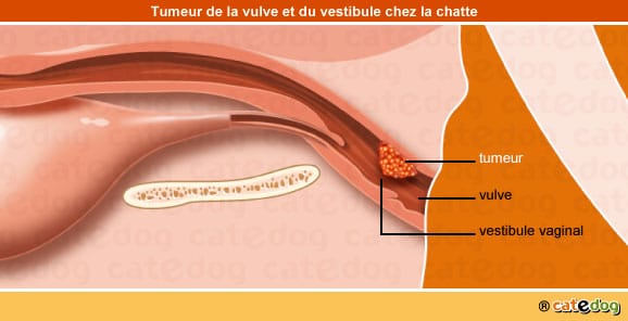 tumeur-maligne-benigne-metastases-vulve-vestibule-chatte
