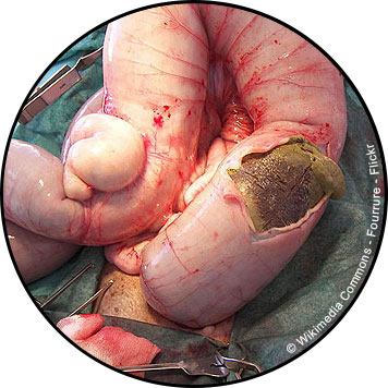 Occlusion intestinale chez le chien et chat avec fécalome
