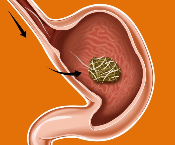 Boule de poil chez le chat avec occlusion intestinale