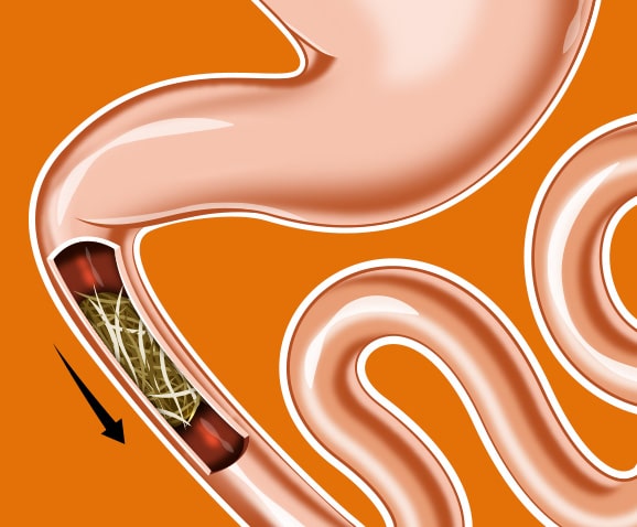 Boule de poil chez le chat avec occlusion intestinale