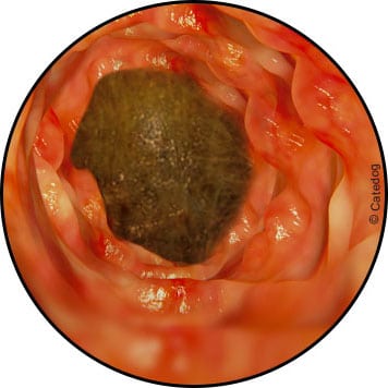 Boule de poils chez le chat provoquant une occlusion intestinale