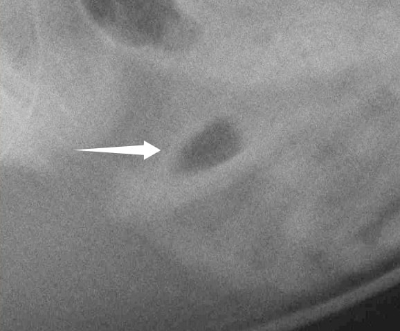 Traitement par chirurgie d'une occlusion intestinale du chat