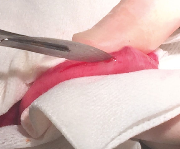 Traitement par chirurgie d'une occlusion intestinale du chat