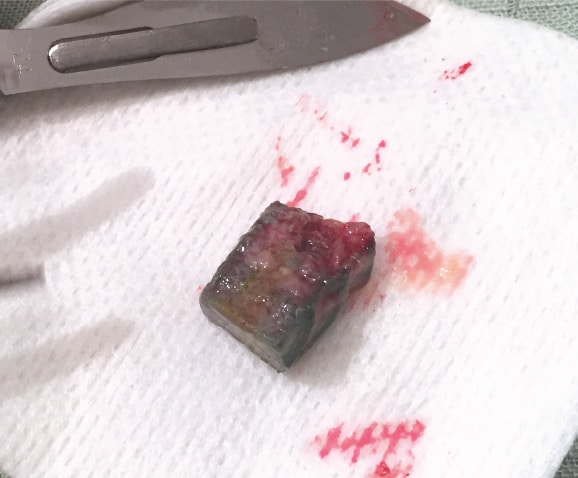 Traitement par chirurgie d'une occlusion intestinale du chat