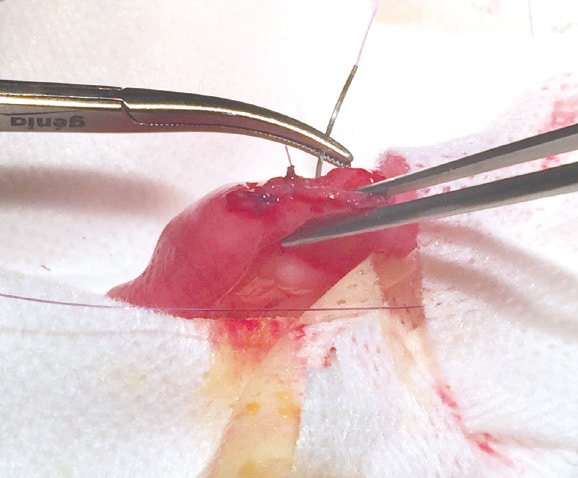 Traitement par chirurgie d'une occlusion intestinale du chat