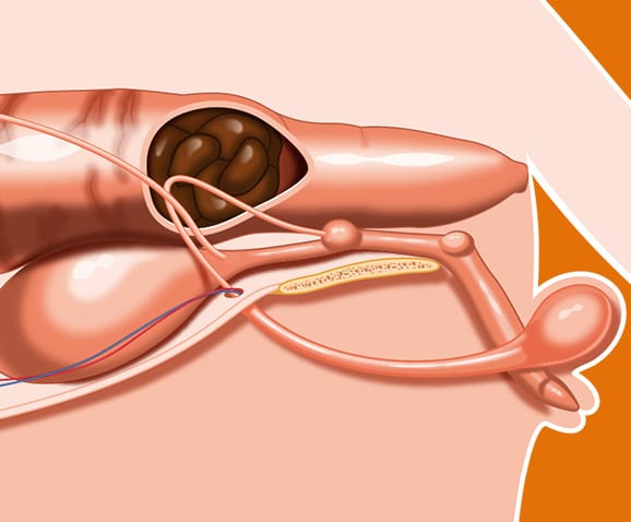 Occlusion intestinale chez le chat et fécalome