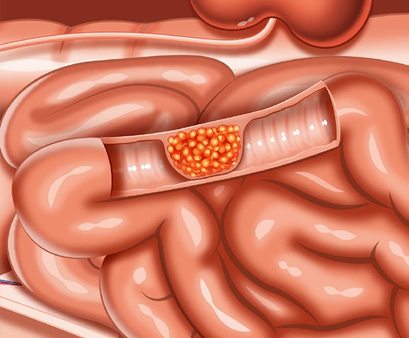 Occlusion intestinale chez le chat et le chien et tumeur